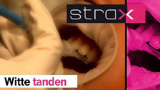 Witte tanden